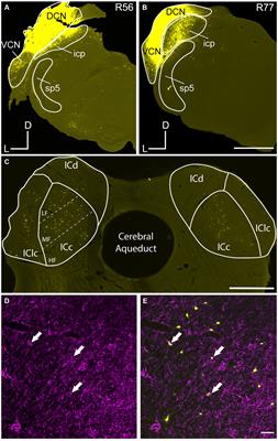 Age-related upregulation of perineuronal nets on inferior collicular cells that project to the cochlear nucleus